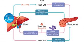 Diabetes And Insulin Diabetes And Insulin
